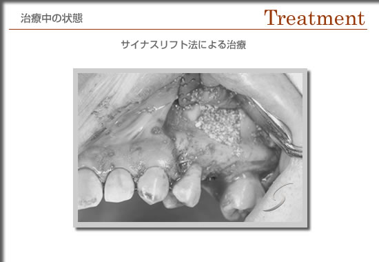 症例外科beforr01.jpg